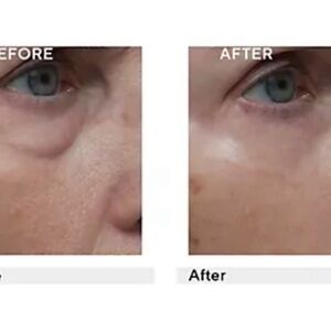 Dr Denese NEW Sealed in Box - 3 Minute Wrinkle Reducer